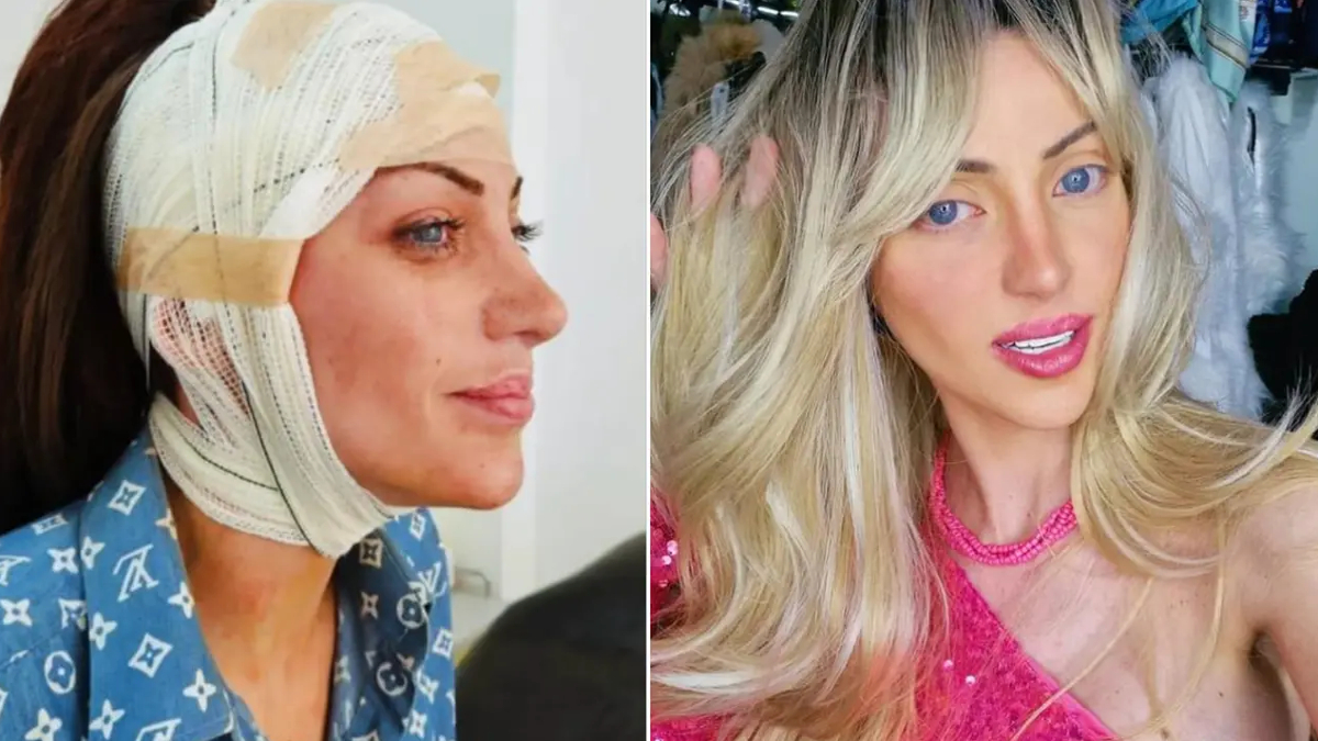 barbie bebege benzemek icin 27 kez ameliyat oldu brezilyali fenomen 31 yasinda hayatini kaybetti WjkOedYe.jpg